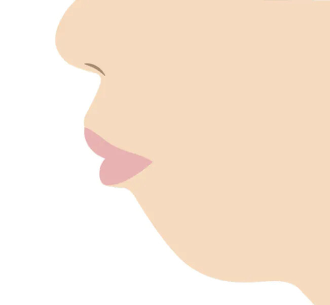 口ゴボってどんな状態？