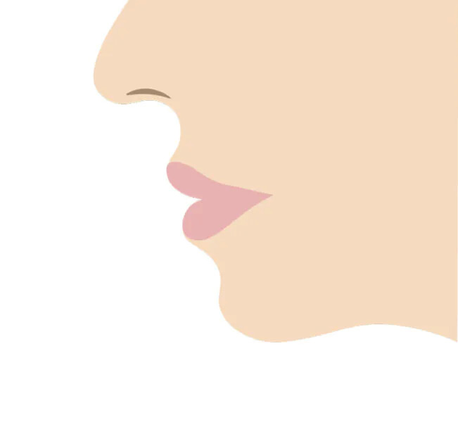 口ゴボってどんな状態？