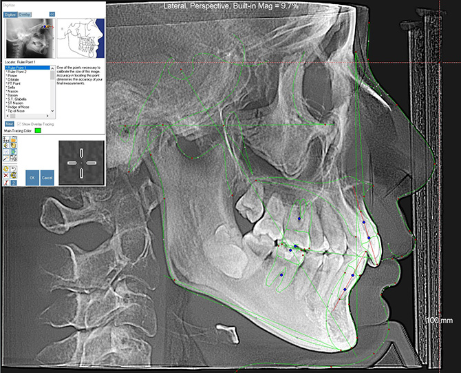 3Dモデルによる検査および簡易診断