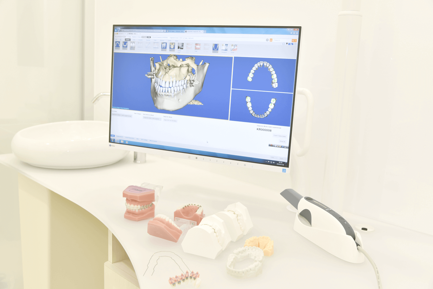3Dデジタル矯正の治療内容ページのトップ画像