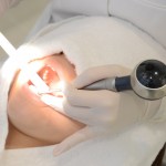 歯のクリーニング中の写真