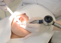 歯のクリーニング中の写真
