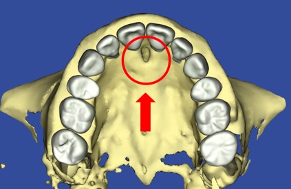 切歯管と歯根の距離を適切にした3D