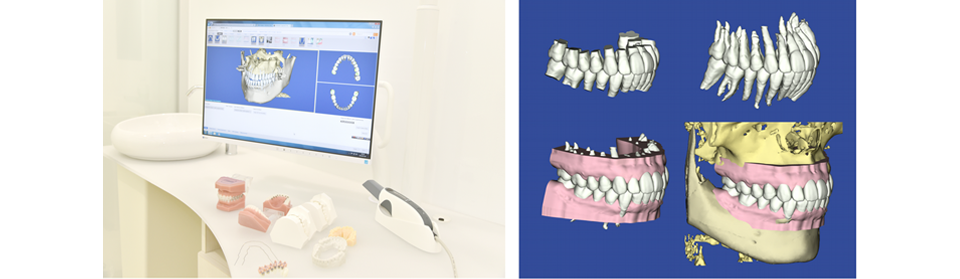 日本橋はやし矯正歯科クリニック内と3Dデジタル矯正のイメージ画像