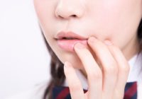 口唇閉鎖不全（ポカン口）はデメリットがいっぱい？治療方法と事例を紹介